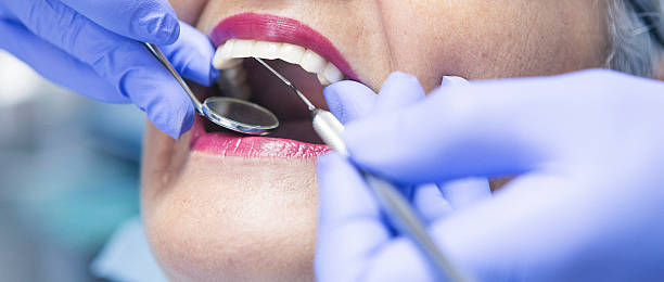 Best Emergency Treatment for Dental Infections or Abscesses in Brilliant, AL